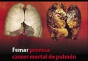 Destruir�n cajetillas de cigarrillos sin pictogramas de advertencia del riesgo de fumar