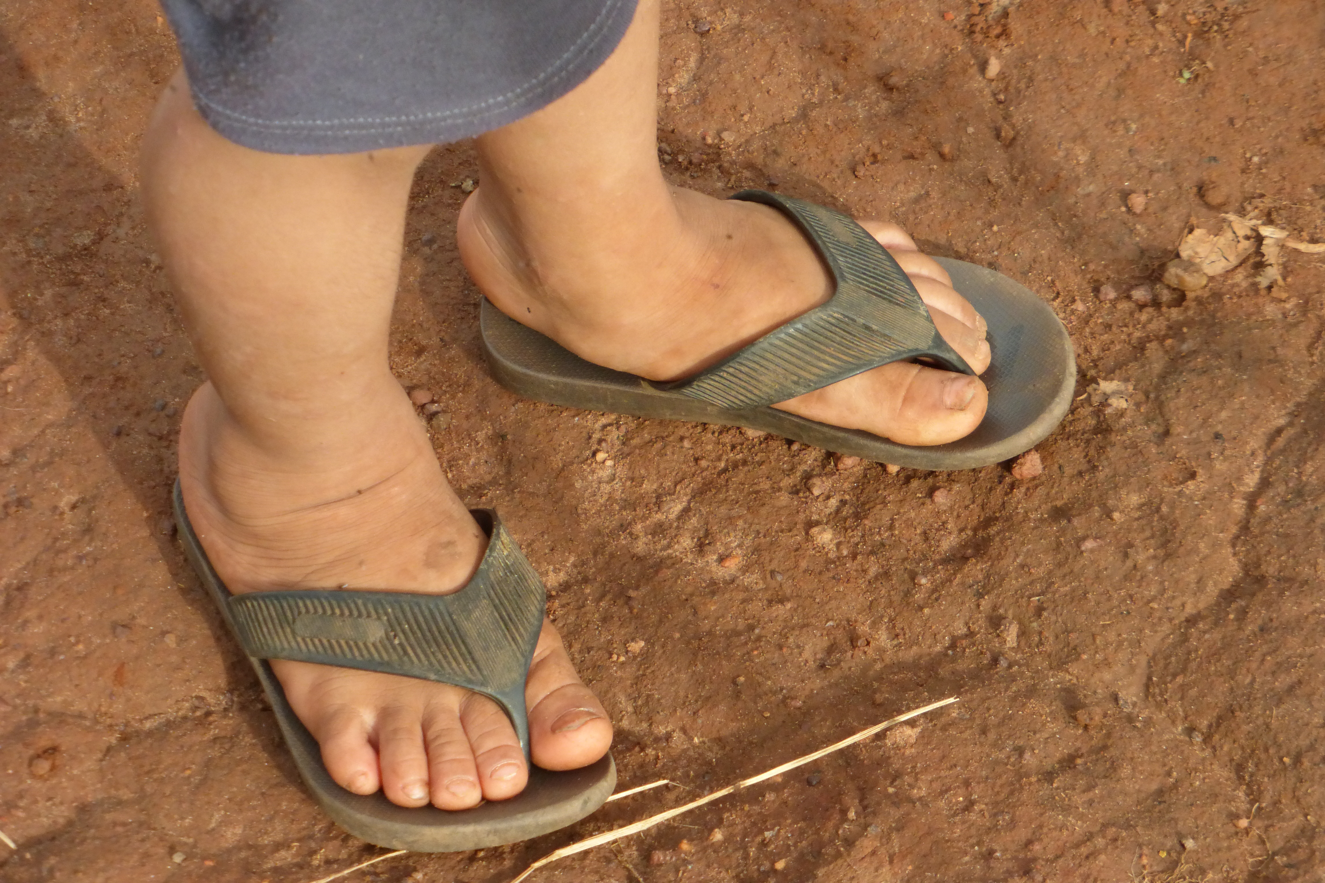 Los pies de un niño de la comunidad El Regreso. Foto: Karem Mendoza