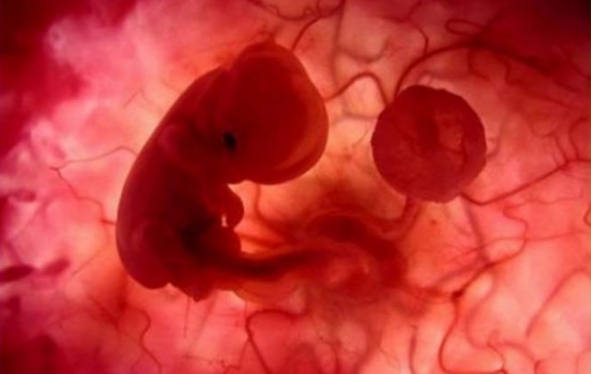 Bolivia debate la despenalización del aborto/Foto archivo movimientoliberati.com