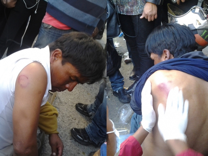 Dos manifestantes con heridas de balines. Foto: ANF
