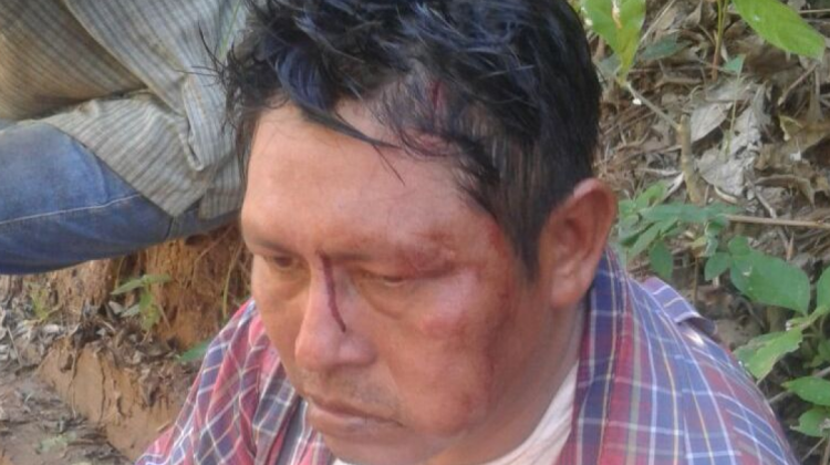 Uno de los heridos en los enfrentamientos por tierra. Foto: Jhony Rojas