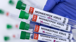 Los casos de viruela del mono bajan un 6% en la última semana a nivel mundial, según la OMS