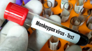 La OMS cambia el nombre de la viruela del mono por mpox para evitar el "lenguaje racista y estigmatizante"