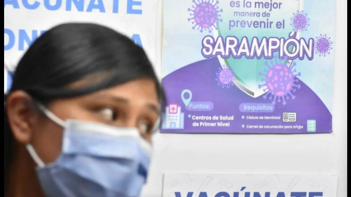 Los contagios de sarampión se incrementan en el país. Foto: Internet