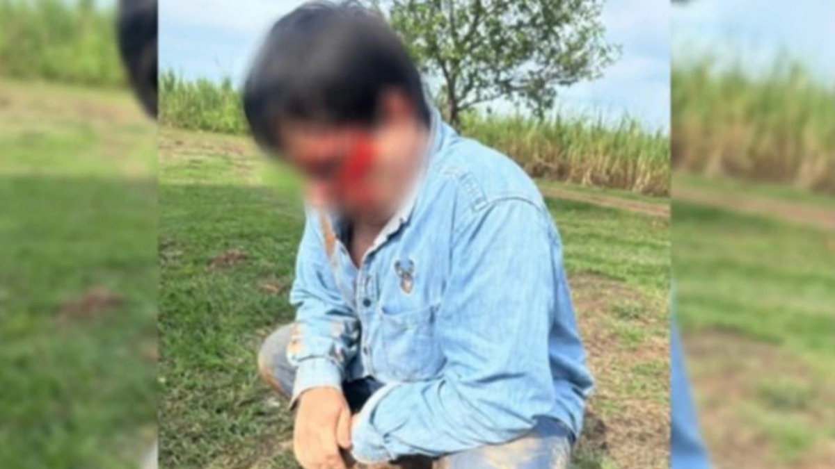 Pablo Vaca Díez herido por los avasalladores. Foto: El Deber