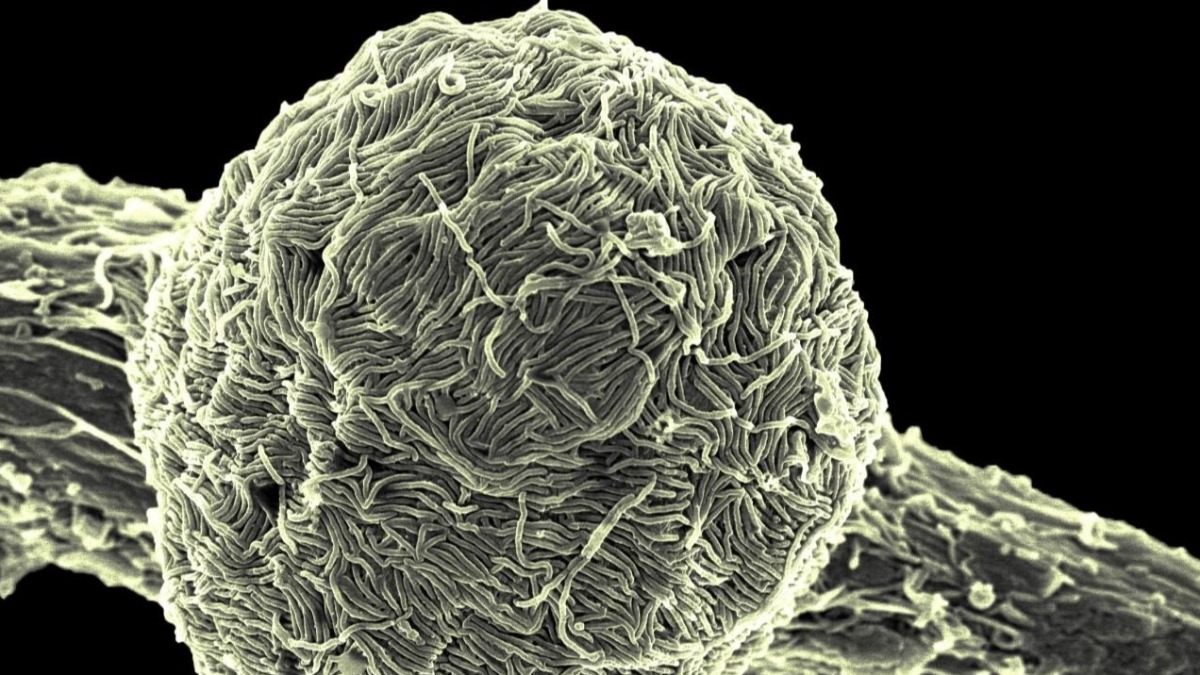 La variante Makona del virus del ébola cubre la superficie de una célula infectada.